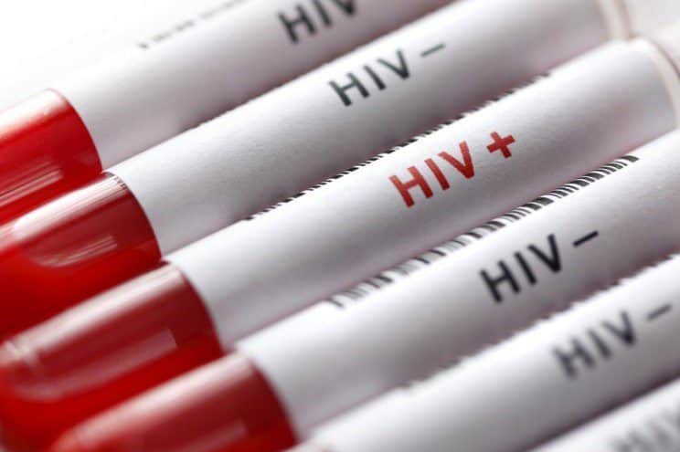 وجود ۲۳۹۰۲ مبتلا به HIV در ایران