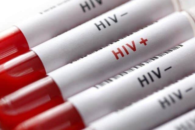آخرین وضعیت بروز HIV در کشور