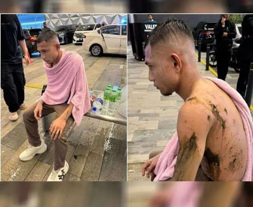 ملی‌پوش فوتبال قربانی اسید‌پاشی شد!