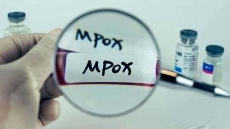 پاکستان چند فرودگاه را به دلیل شیوع ام‌پاکس ضدعفونی کرد