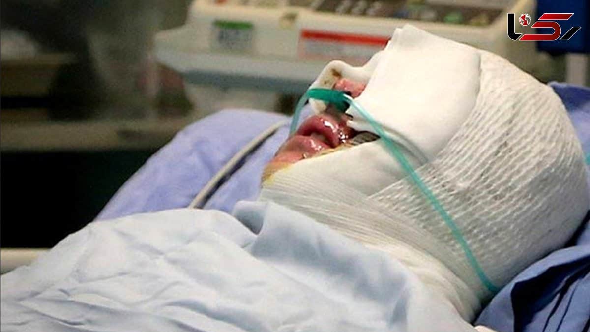 اسید پاشی روی صورت خانم ناظم مدرسه درکرج
