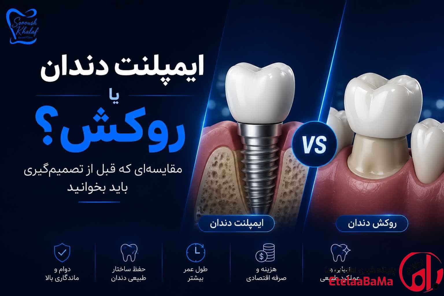ایمپلنت دندان یا روکش؟ مقایسه‌ای که قبل از تصمیم‌گیری باید بخوانید